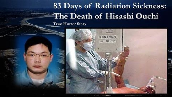 The Tragic "Hisashi Ouchi Case": A Lesson In Nuclear Disaster Management